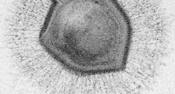 بعض الفيروسات لها جهازها المناعي الخاص بها