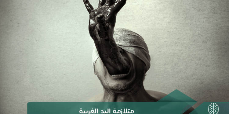 متلازمة اليد الغريبة