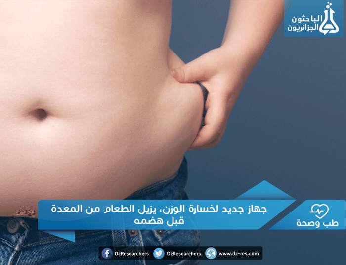 جديد لخسارة الوزن، يزيل الطعام من المعدة قبل هضمه e1467079216321