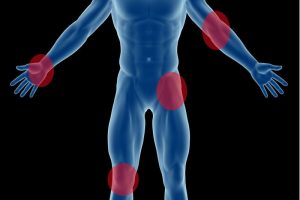 Arthrose.jpg.3114200