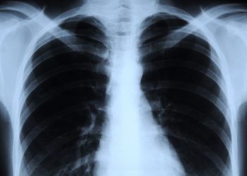 الأشعة السينية X_Rays