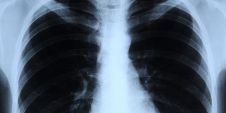 الأشعة السينية X_Rays